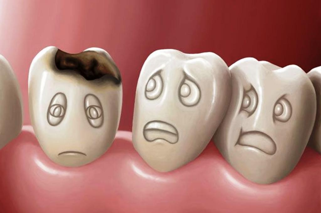 Мой стоматолог очень удивился, когда узнал, как я снимаю зубную боль. Нужны гвоздика и кокосовое масло
