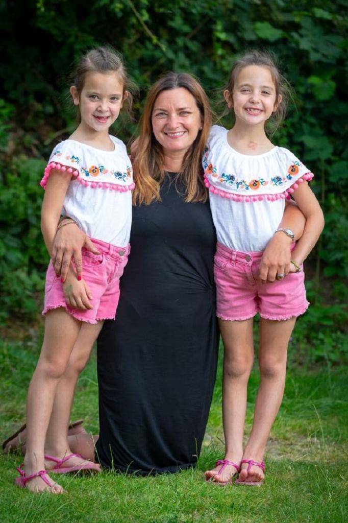 В 2012 году женщина родила сиамских близнецов, которых сразу же было решено разделить. Как они выглядят через 7 лет