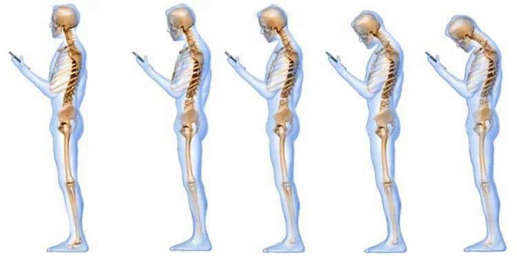 Эволюция в действии: ученые обнаружили, что у людей выросла «смартфонная» кость