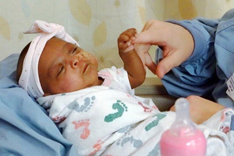 Самая маленькая недоношенная девочка в мире родилась с весом 245 грамм: что с ней сейчас