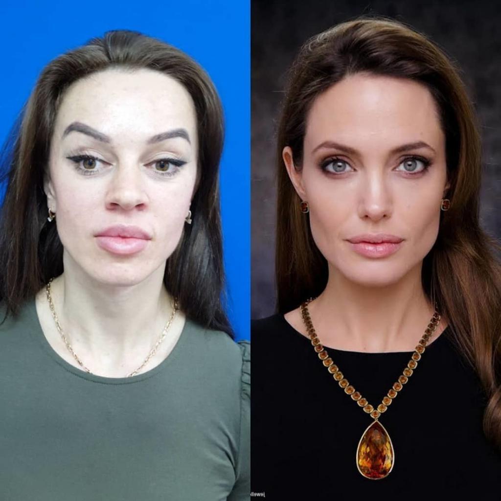 Женщина решила стать точной копией Анджелины Джоли: муж поддерживает ее морально и финансово