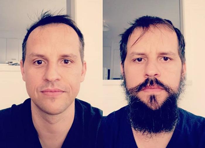 Чудесная метаморфоза: как мужчин может изменить борода. Фото до и после