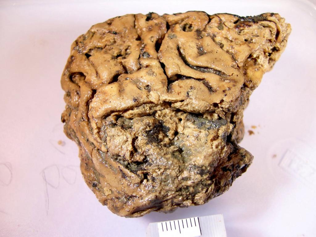 Секреты хорошо сохранившегося 2600-летнего человеческого мозга: исследование