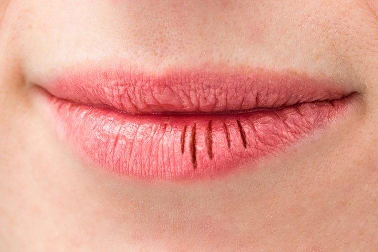 На поврежденные губы помаду наносить нельзя: косметологи отметили основные ошибки в использовании губной помады