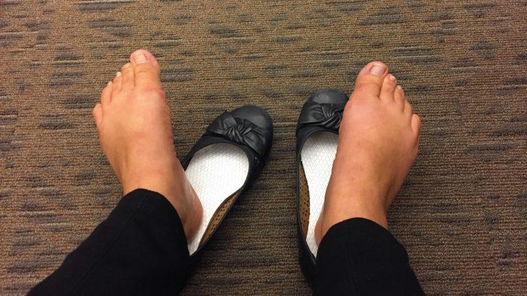 Одну и ту же пару обуви носить каждый день не рекомендуется: ноги потеют сильнее, чем мы думаем
