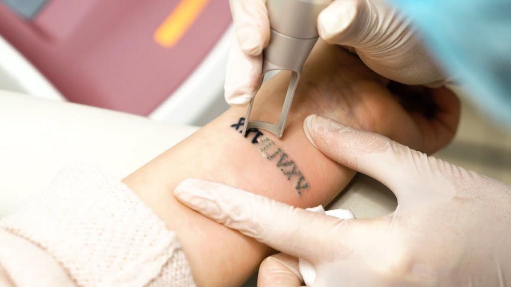 Больно, страшно и опасно: 4 мифа об удалении татуировок