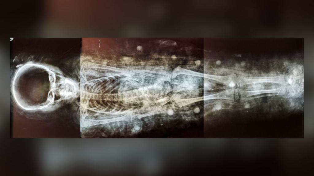 Компьютерная томография помогла воссоздать внешность мумифицированного мальчика