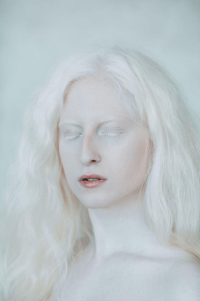 Серия снимков девушки-альбиноса и темнокожей модели: как Луна и Солнце