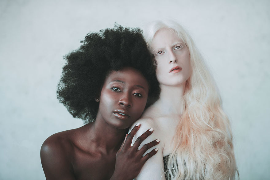 Серия снимков девушки-альбиноса и темнокожей модели: как Луна и Солнце