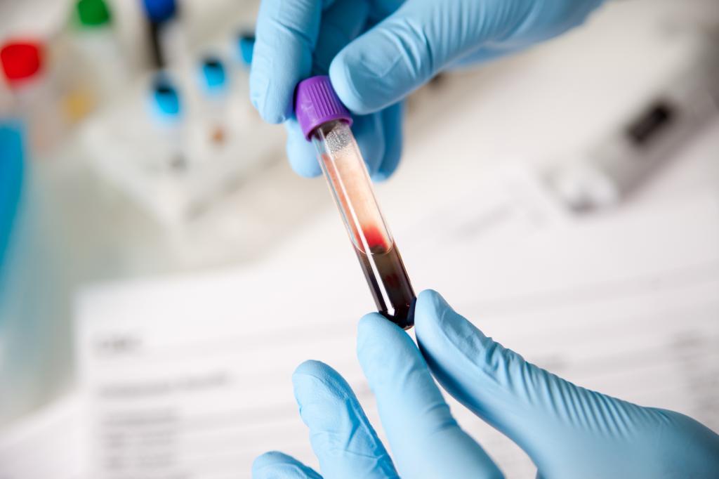 Люди с нулевой группой крови могут быть менее подвержены риску заражения Ковид-19 и тяжелого протекания болезни, показывают два новых исследования