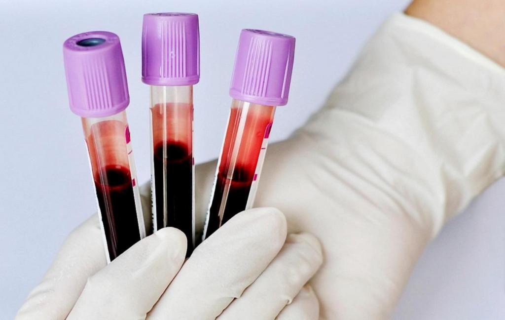 Группа крови и Covid 19. Ученые узнали, кто легче всего переносит болезнь