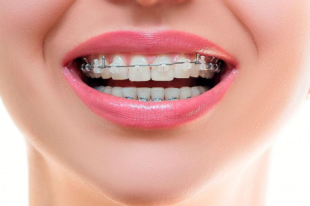 Не чаще одного раза в два года: врачи рассказали, когда стоит посещать стоматолога в профилактических целях и какие опасности могут ждать в кабинете "зубника"