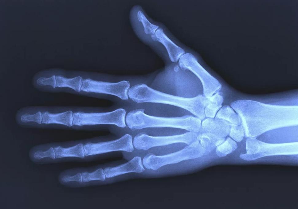 Рентгеновские лучи: как открытие, совершенное 125 лет назад, изменило нашу жизнь