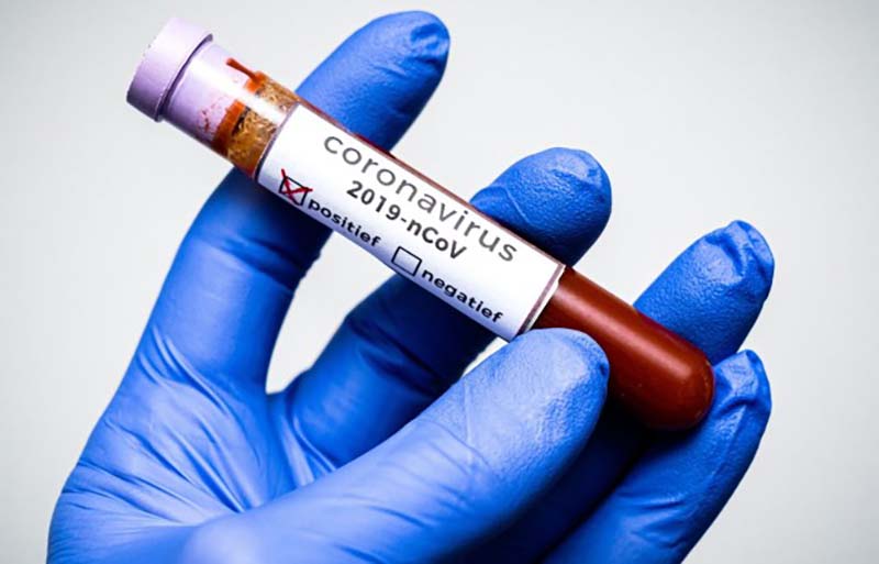 Вирусологи прокомментировали выявленные мутации коронавируса
