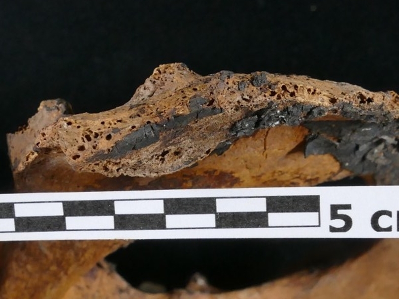Первые гинекологи появились в Египте еще 4000 лет назад: мумию со следами древнейшего лечения обнаружили ученые