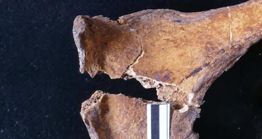 Первые гинекологи появились в Египте еще 4000 лет назад: мумию со следами древнейшего лечения обнаружили ученые