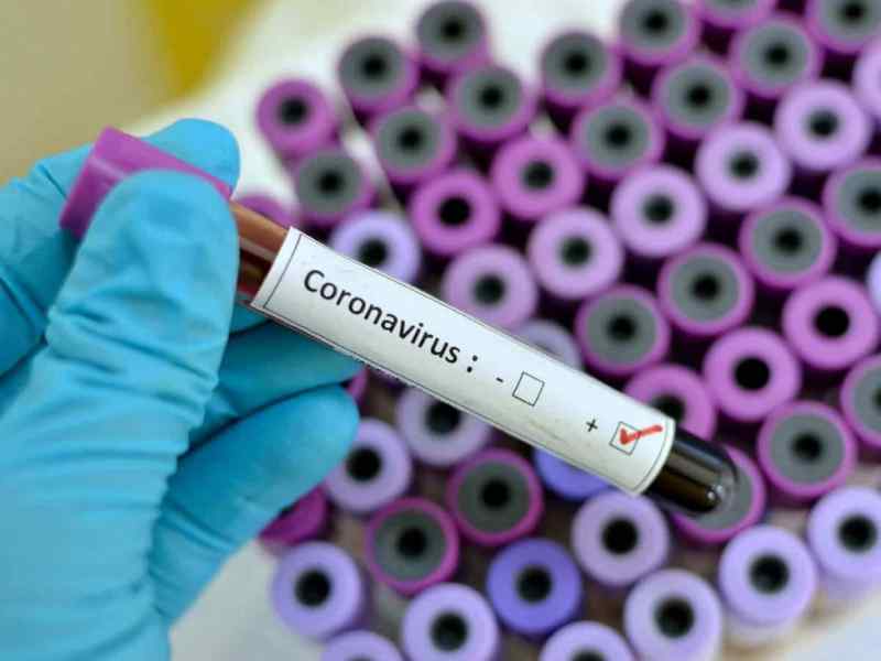 "Кажется, у меня COVD": как отличить лжекоронавирус от реальной болезни