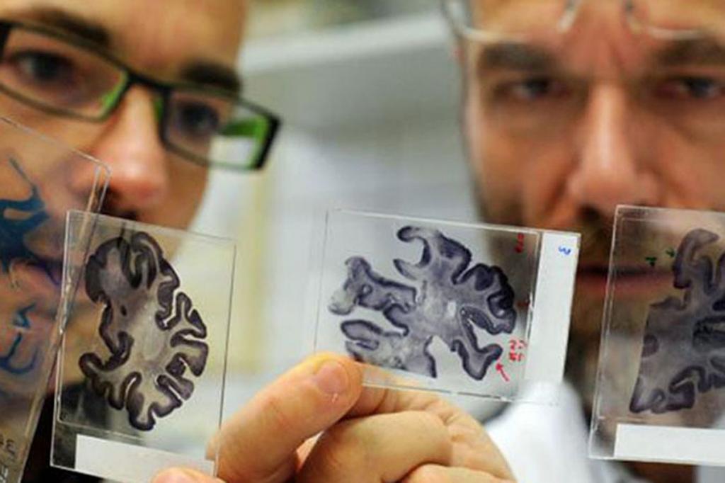 Ученые выяснили, как уменьшить риск появления болезни Альцгеймера: для этого стоит перестать тревожиться по мелочам