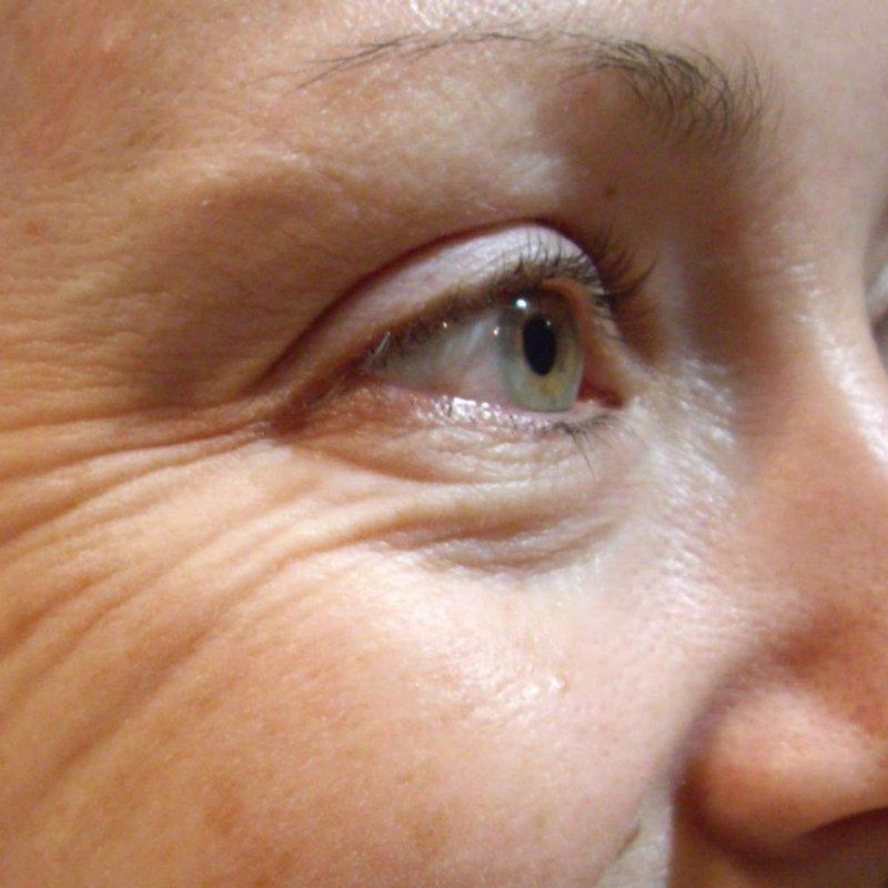 Круговые движения и жирный крем точно не для век: что женщинам старше 40 нельзя делать, ухаживая за кожей вокруг глаз (а то морщин будет в два раза больше)