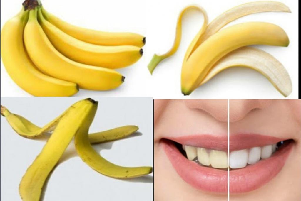 По совету стоматолога сама отбеливаю зубы домашними безопасными способами. Подойдет шалфей, яблочный уксус и другие средства