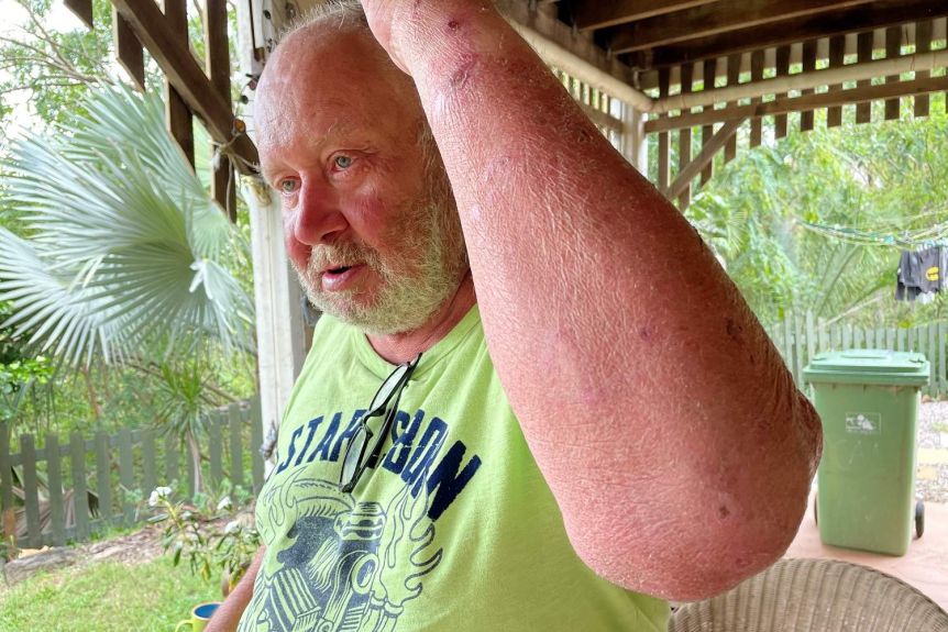 Австралиец 18 дней провел в лесу: 58-летний мужчина похудел на 10 кг и рассказал, что помогло ему выжить