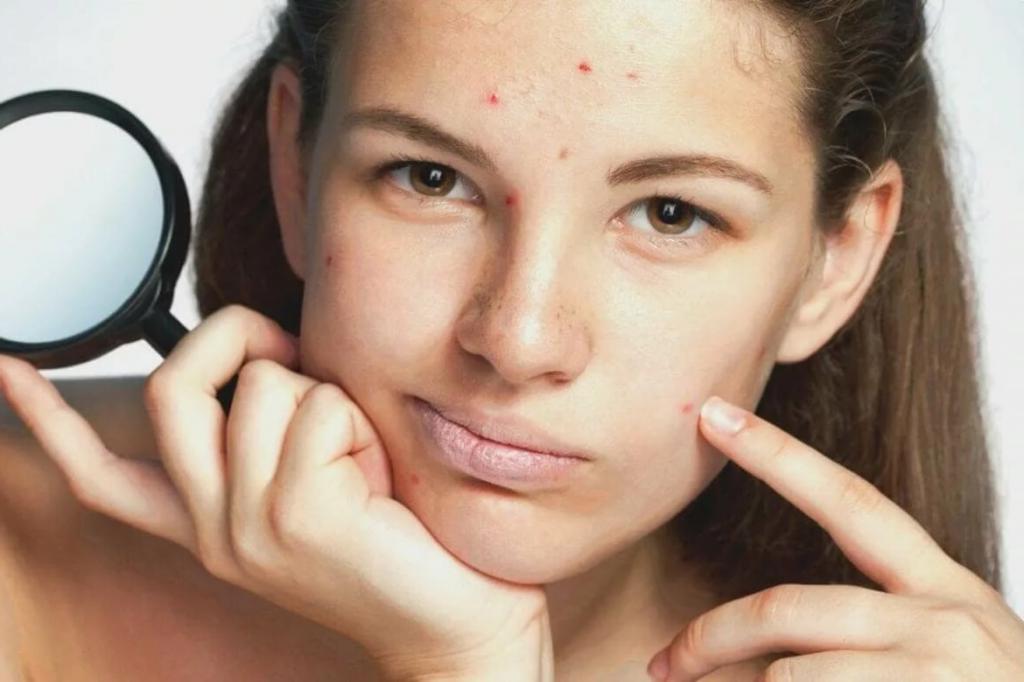 Долой идеальную кожу, да здравствует естественность: британским бьюти-блогерам запретили ретушировать фото