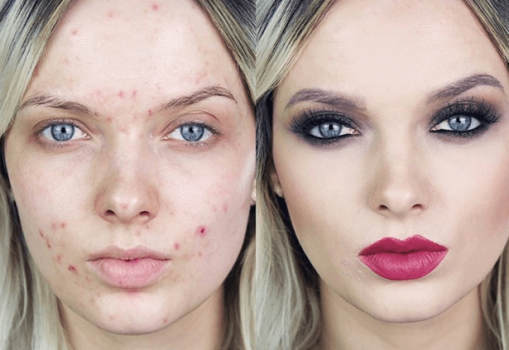 Долой идеальную кожу, да здравствует естественность: британским бьюти-блогерам запретили ретушировать фото