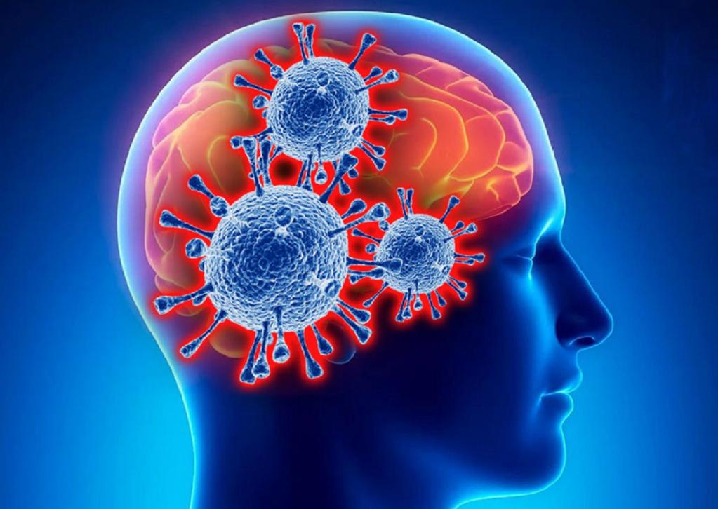 Ученые: COVID-19 может навсегда оставаться в головном мозге человека