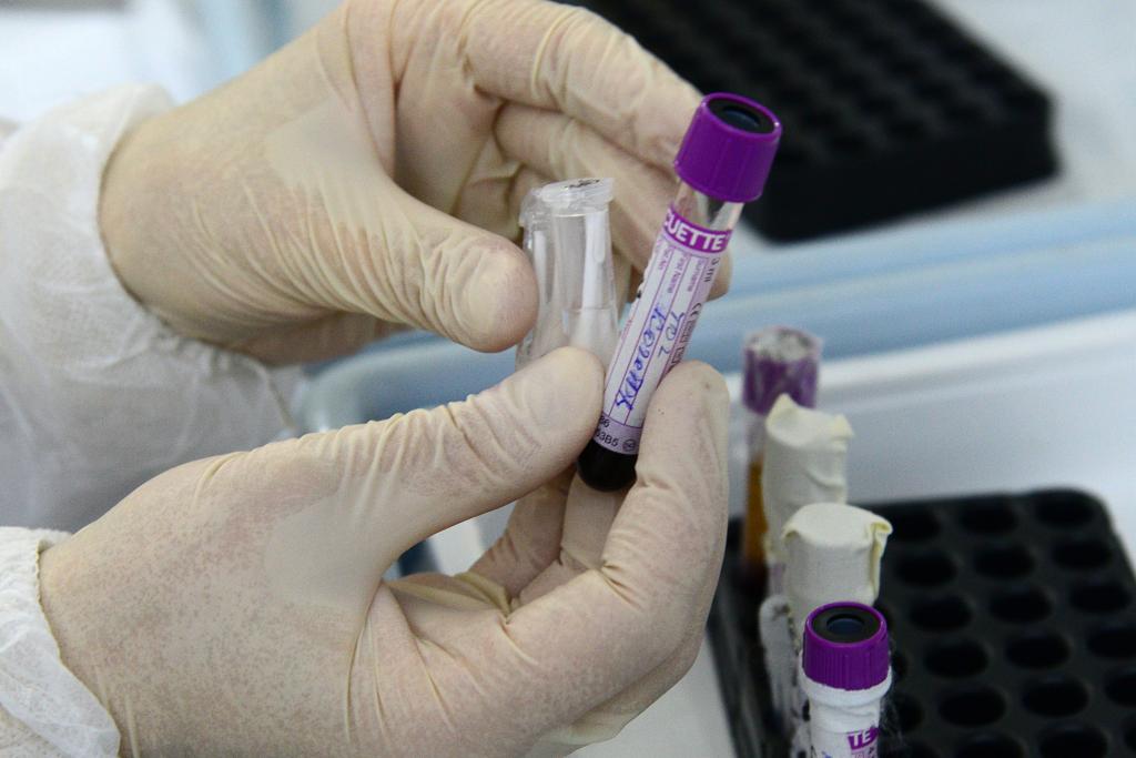 ВОЗ сообщила о выявлении нового штамма коронавируса еще в нескольких государствах. Теперь он зафиксирован в 101 стране