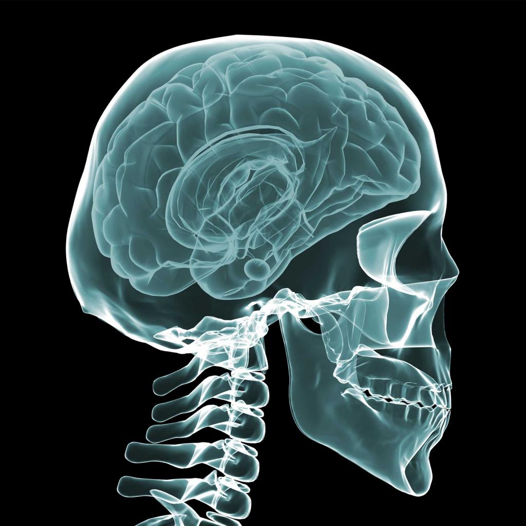 Ученые из Университета Токай в Японии смогли обнаружить шизофрению на рентгеновских снимках