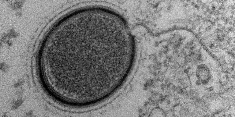 Только осторожней! Российские ученые изучат древние вирусы из вечной мерзлоты возрастом 200 тысяч лет