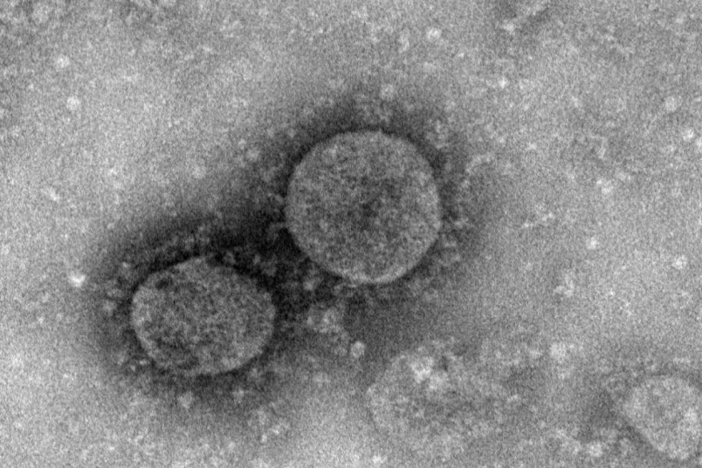 Откуда появился коронавирус: исследование ВОЗ в Ухане не дает окончательных ответов о происхождении COVID-19