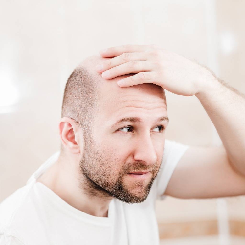 Почему из-за стресса выпадают волосы: ученые Гарвардского университета определили, как это происходит