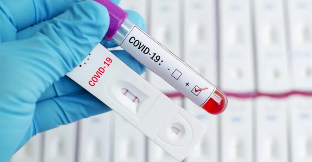 "Одни вырабатываются через неделю и, как правило, указывают на острое течение COVID-19": в Роспотребнадзоре объяснили разницу между антителами М и G к коронавирусу