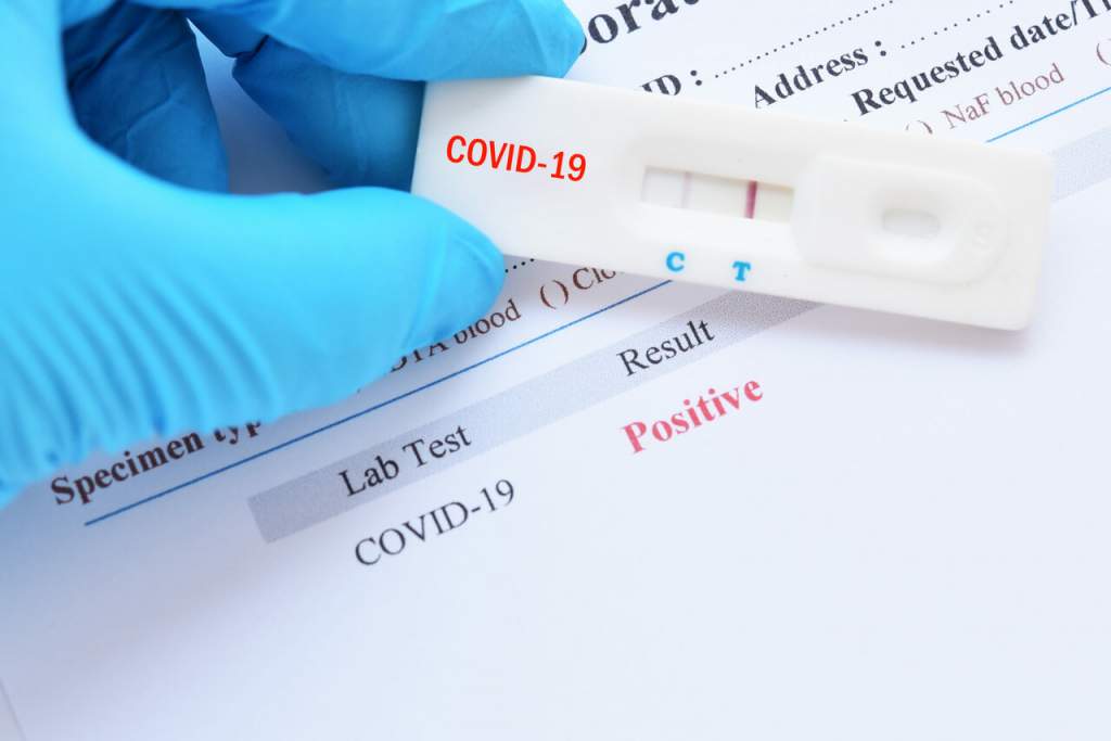 Россиянам рассказали, почему даже прошедшим вакцинацию от COVID-19 необходимо сдавать тесты на коронавирус при возвращении из-за границы