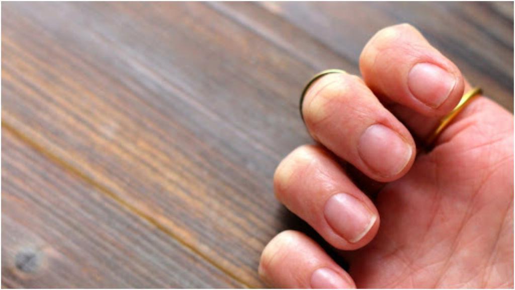 "Тест" на антитела по рукам: эксперты сообщили о "ковидных ногтях"