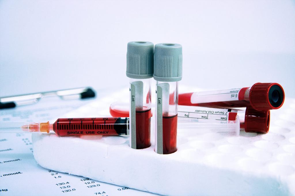 Новое исследование ученых позволит выбирать наиболее эффективный режим тренировок по анализу крови спортсмена