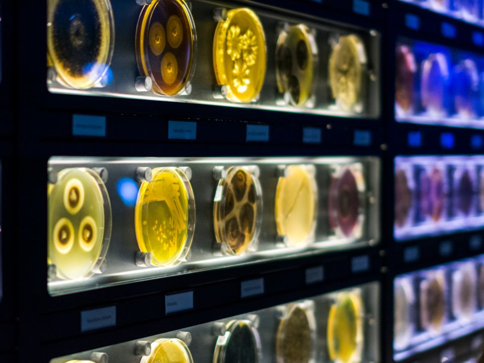 Лапша, волосы, микробы: 10 самых странных музеев со всего мира
