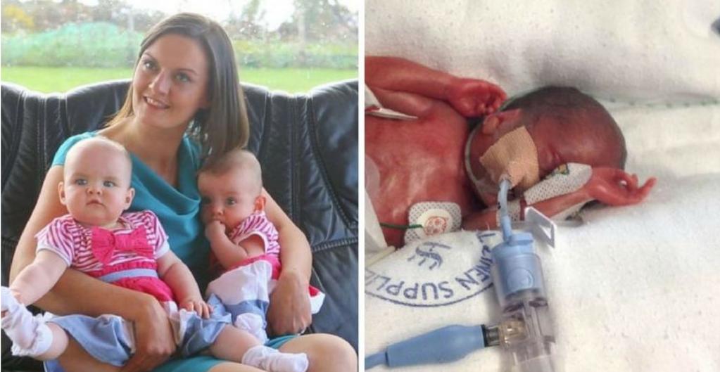 Связанные одной нитью: чудо-близняшки родились с перерывом в 87 дней