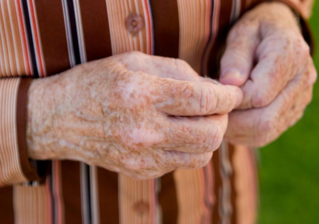 Возрастные пятна у пожилых людей: откуда они берутся и способы от них избавиться