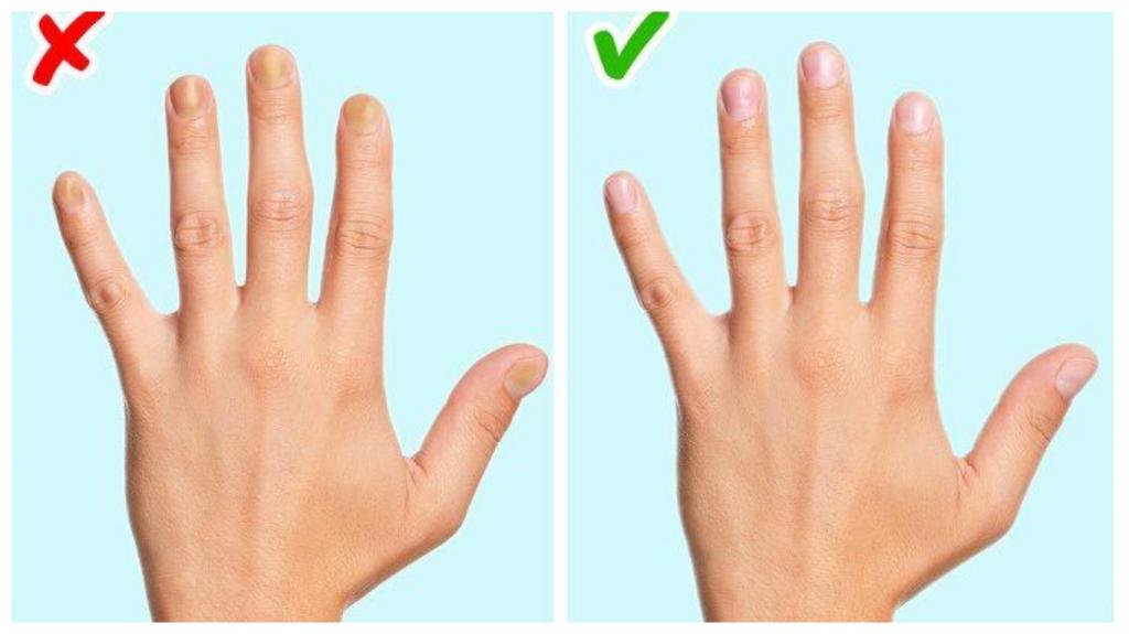 Длина пальца, мочка уха и другие необычные признаки сердечно-сосудистых заболеваний