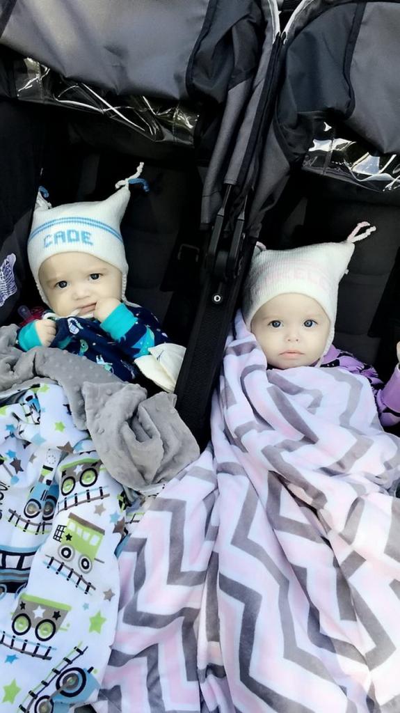 Не ждали: врачи чуть не "пропустили" близнеца во время родов