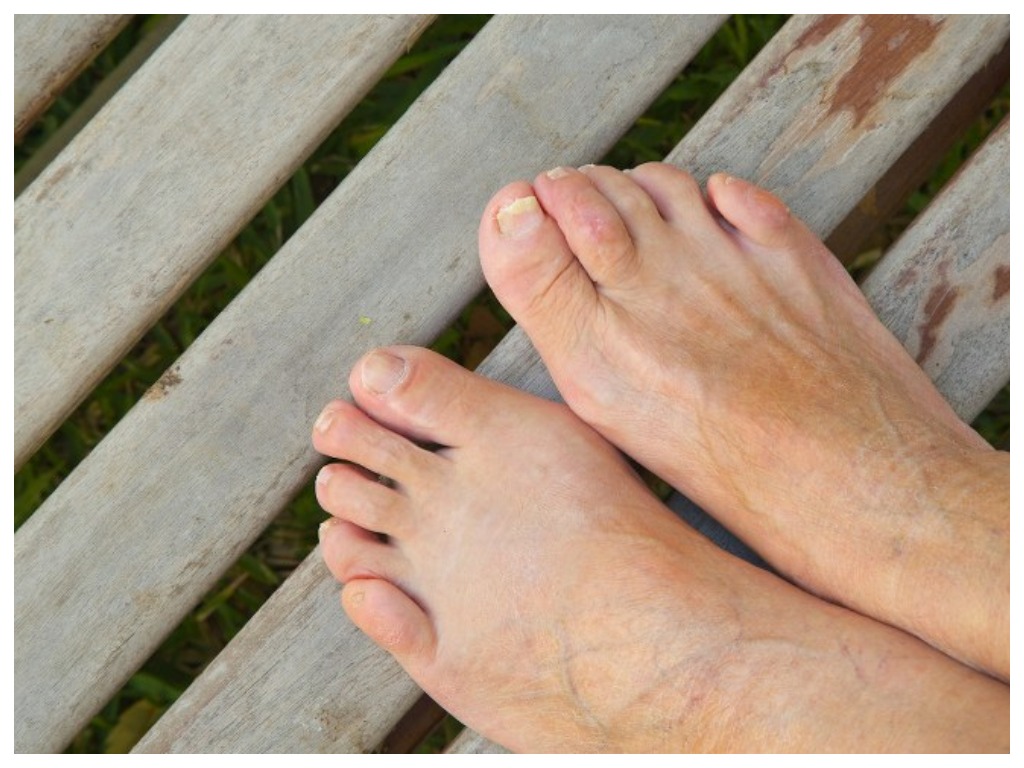 Что происходит с нашими ногами, когда мы стареем: влияние возраста на наши ступни и лодыжки