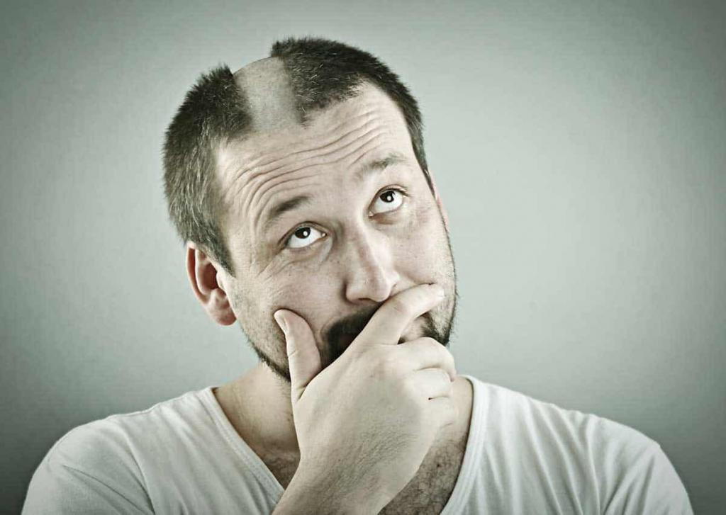Не прячьте свою красоту под париком: новые исследования признали лысых мужчин более привлекательными