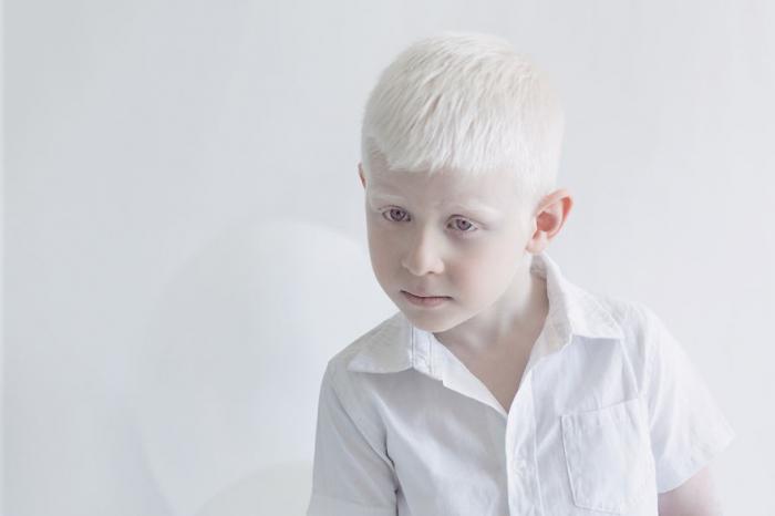 альбинос фото красота белый люди проект сказочный мир альбиносов