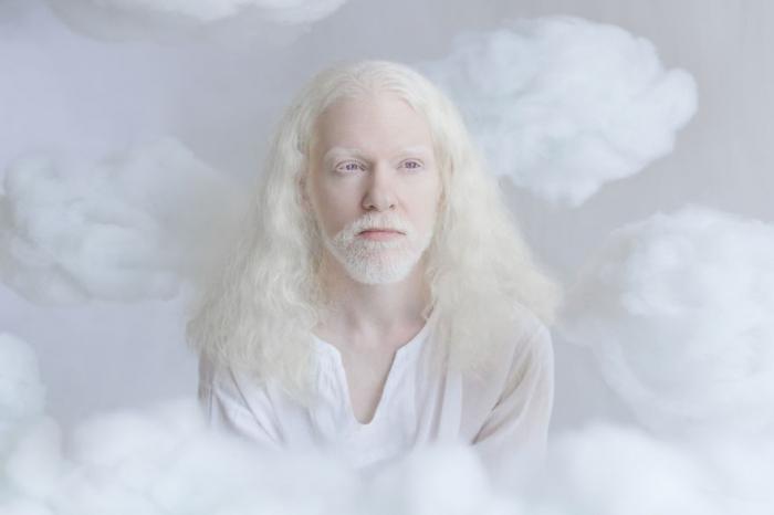 альбинос фото красота белый люди проект сказочный мир альбиносов