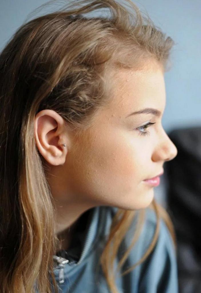 Девочка проколола ухо в необычном месте, чтобы справиться с мигренью, это стало поводом ее отстранения от школы
