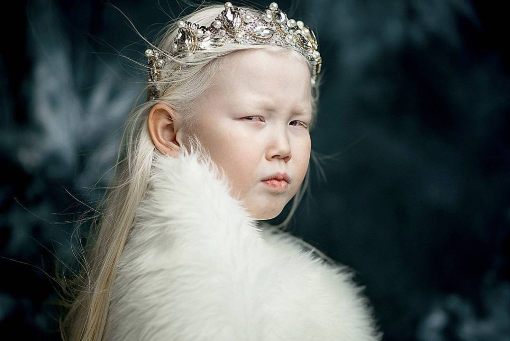 "Белоснежка" из Сибири: 8-летней якутке с редчайшей внешностью прочат карьеру модели