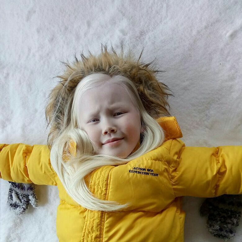 "Белоснежка" из Сибири: 8-летней якутке с редчайшей внешностью прочат карьеру модели