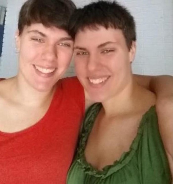 Как сегодня выглядят сестры-близняшки со знаменитого на весь мир снимка (фото)